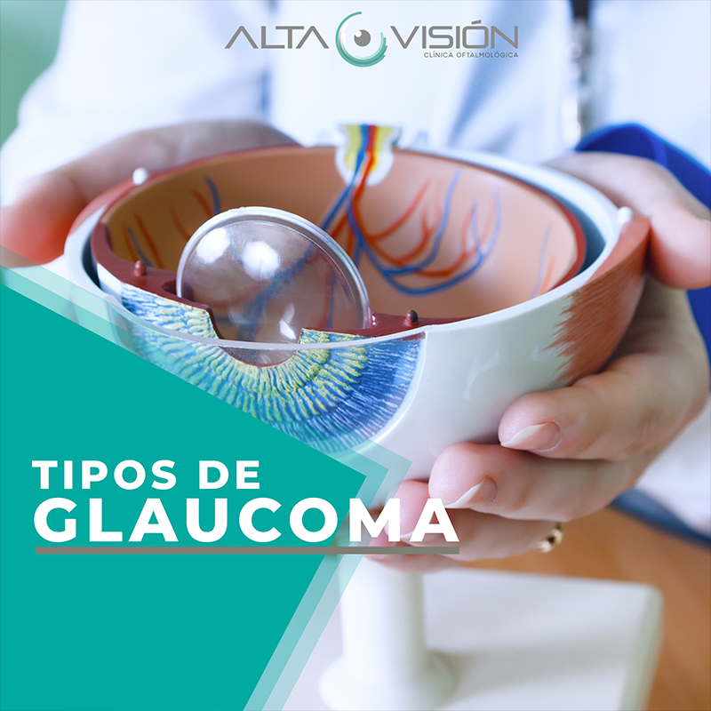 Tipos de Glaucoma