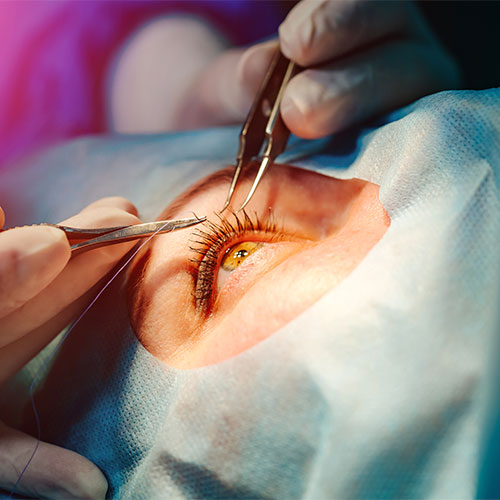 Consulta oftalmológica especializada en glaucoma